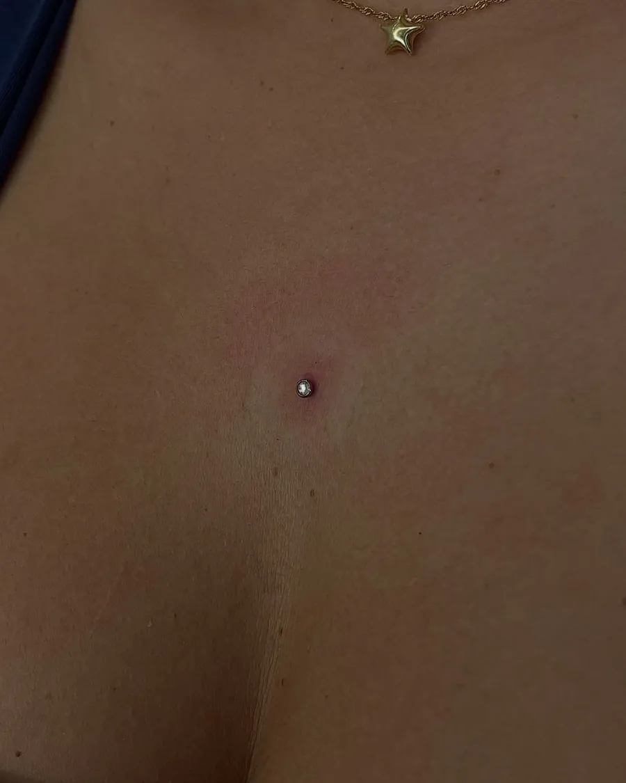 Microdermal no colo, com topo de pedra